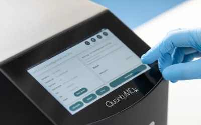 What are the benefits of adding LIS connectivity to a POC platform?